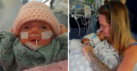 Born At Weeks And Contracting Sepsis Baby Aurora Has Defied The Odds