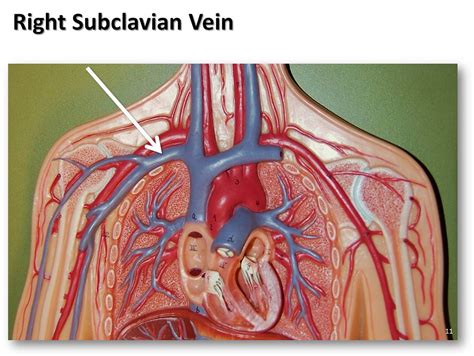 They accompany the arteries of the. Right subclavian vein - The Anatomy of the Veins Visual Gu ...