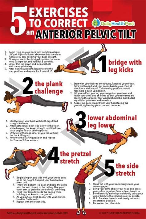 Exercises To Correct An Anterior Pelvic Tilt To Get Rid Of Hip Lower Back Pain Pelvic Tilt