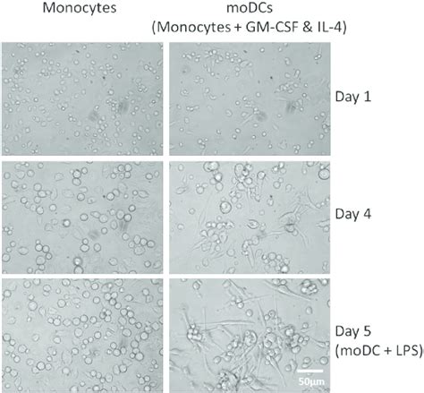 Light Microscopy Images Of Monocytes And Modcs After 1 4 And 5 Days Of