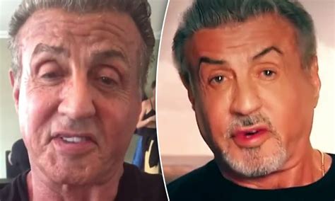 Sylvester Stallone Before And After Plastic Surgery