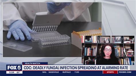 Cdc Deadly Fungal Infection Candida Auris Spreading At Alarming Rate