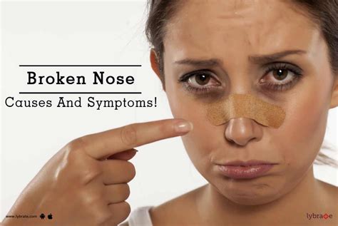 Broken Nose Causes And Symptoms By Dr Gaurav Shekhar Lybrate