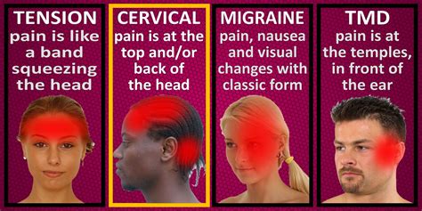 Long Term Effects Of Spinal Headache Martlabpro