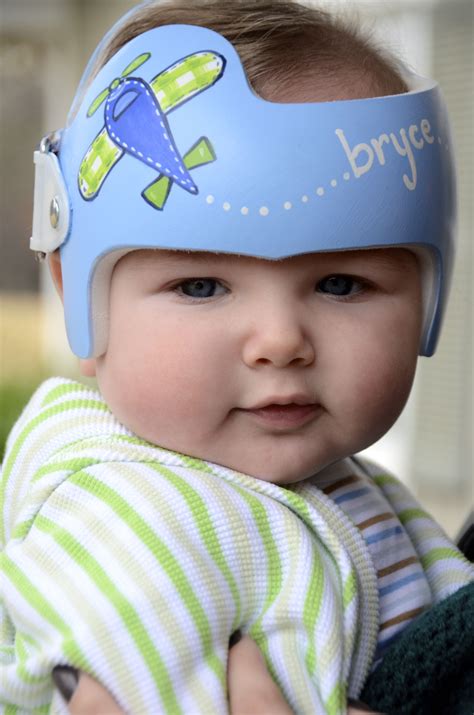 Pin By Leigh Gibson On Cranial Bandshelmets Baby Helmet Doc Band
