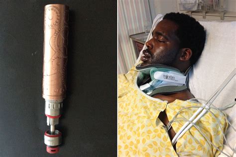 Man Left With Horrific Injuries And Broken Neck After E Cig Explodes In