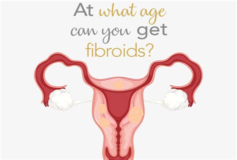 Fact Friday At What Age Can You Get Fibroids Fibroid Treatment Clinic
