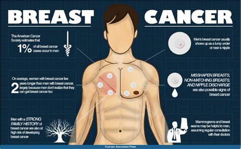 Breast Cancer Can And Does Happen To Men
