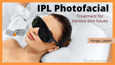 Ipl Photofacial Treatment For Various Skin Issues Kobe Trambellir