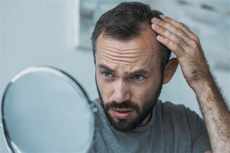 Common Causes Of Hair Loss In Men Distefano Hair Restoration Center