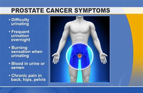 What Is Prostate Cancer 9 Signs And Symptoms 99 Health Ideas