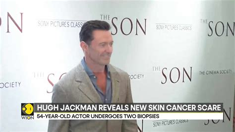 Hugh Jackman Reveals New Skin Cancer Scare Says Please Wear Sunscreen