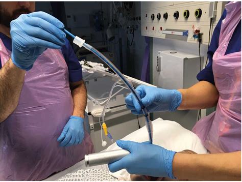 Tracheal Intubation With Stylet Have High First Pass Intubation Success
