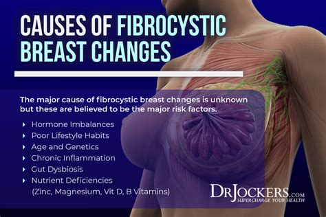 Fibrocystic Breast Changes Causes Symptoms Support Strategies