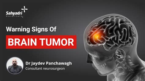 How Long Before Brain Tumor Symptoms Show Brain Tumor Early Symptoms