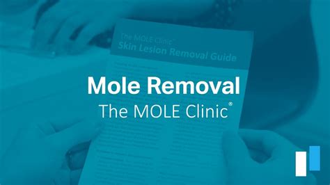 The Mole Clinic® Mole Removal Youtube