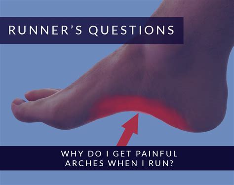 Why Do I Get Painful Arches When I Run Alexandra Sports