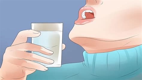 Tonsil Stones 13 Tips To Get Rid Of Tonsil Stones Without Gagging