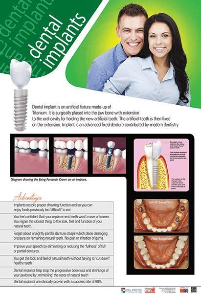 Our posters have been used by companies, organizations, and governments in more than 70 countries around the world to increase. Pin on Dentistry
