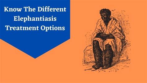 Different Elephantiasis Treatment And Medication Options Livlong