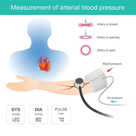 What Is Normal Arterial Blood Pressure