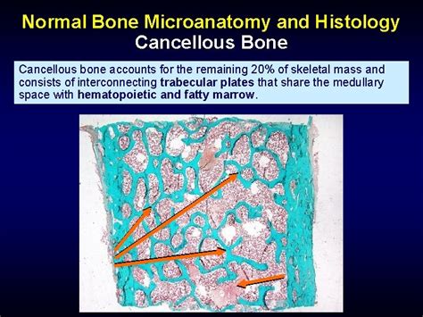 Bone Histology And Histopathology For Clinicians A Primer