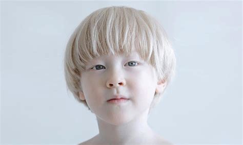 Stunning Portraits Showing Albinism S Beauty