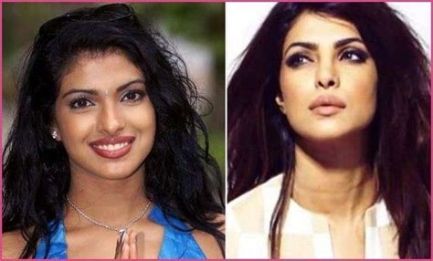 If you have any questions about plastic surgery, i will kindly answer them. Which Bollywood Actresses Look Horrible After Their ...