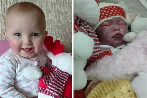 Baby With Meningitis Shown Moments From Death After Being Full Of