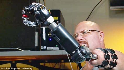 Man Moves His Robotic Arms With His Mind Brain Controlled Prosthetic