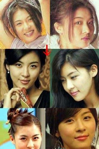 Kim ji hyun had jaw surgery. Ha Ji Won Plastic Surgery Nose Job, Botox Injections ...