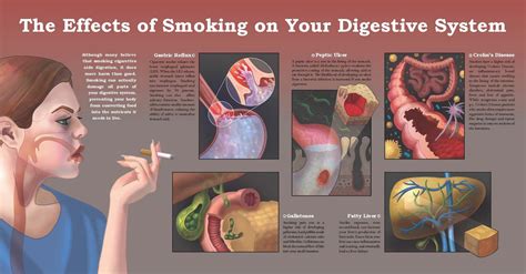 Sara Deckman Portfolio: The Effects of Smoking on Your Digestive System
