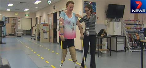 Vic Amputee Takes Major Recovery Step