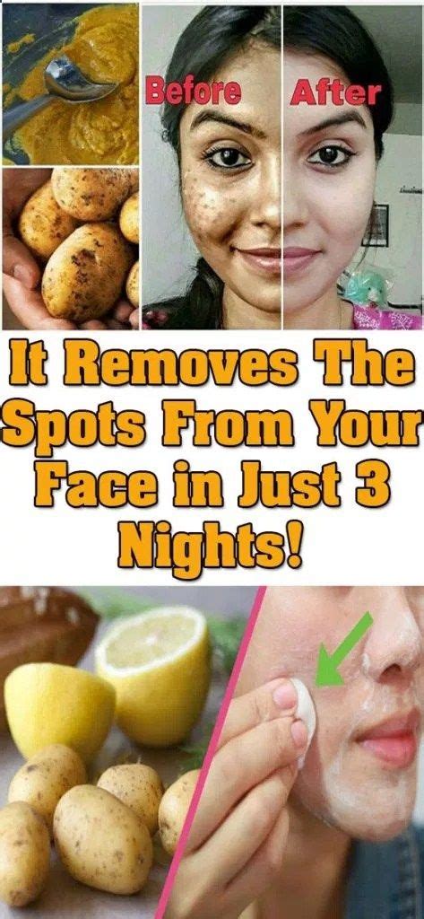 Removes All Spots On Your Face In Just 3 Nights Remove Dark Spots