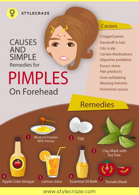 10 Causes Of And Simple Remedies For Pimples On Forehead