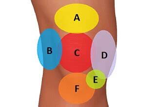 Knee Pain Diagnosis Chart Knee Pain Explained Manminchurch Se