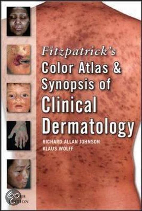 Fitzpatricks Color Atlas And Synopsis Of Clinical Dermatology Ebook