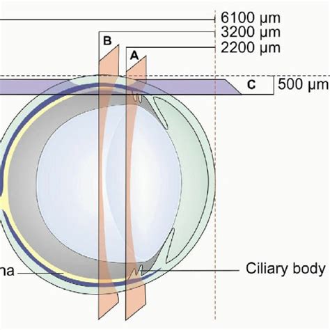 Anatomy Of Ciliary Process Download Scientific Diagram
