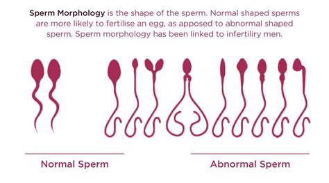How To Read A Sperm Analysis Report NOVA IVF