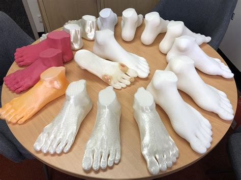 World First 3d Printed Feet Eurekalert