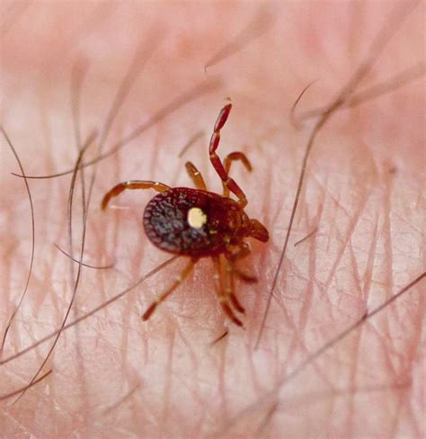 Meat Allergy From Tick Bite A Common Cause Of Anaphylaxis