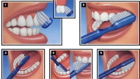 Dental Health Week How To Brush Your Teeth Properly