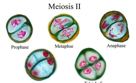 Prophase 1 Stages Under Microscope Micropedia