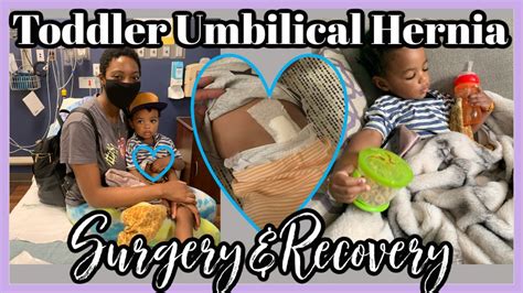 Umbilical Hernia Surgery Toddler Surgery And Recovery Ravin Simone
