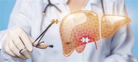 Understanding Fatty Liver Disease And How To Treat It Dr Deetlefs Cpt