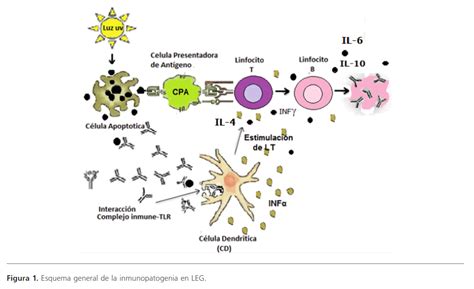 Lupus Eritematoso Generalizado CaracterÃ Â­sticas Generales