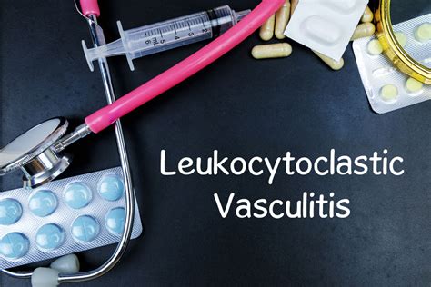 Symptoms And Risks Of Leukocytoclastic Vasculitis Facty Health