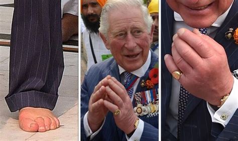 Prince Charles Health Swollen Hands And Feet Condition Laid Bare