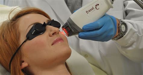5 Types Of Laser Skin Treatments And Their Benefits Health Care Solutions