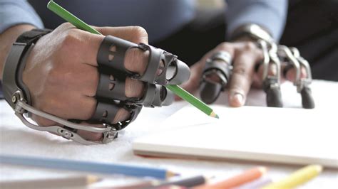 Naked Prosthetics Encourages Amputees To Regain Function With 3d